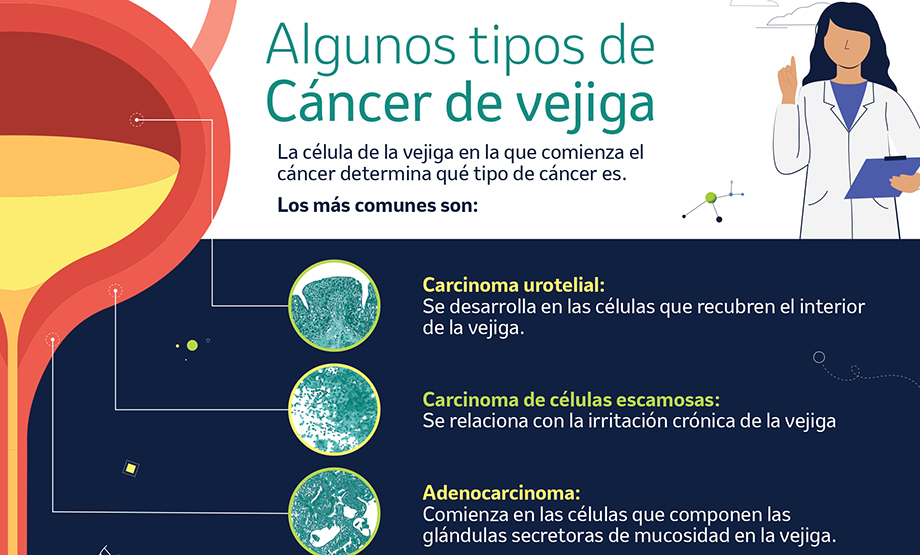 cáncer